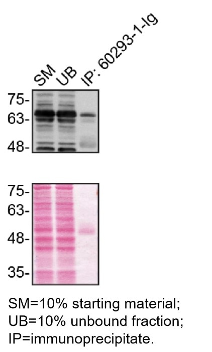 Immunoprecipitation (IP) experiment of U2OS cells using OPTN Monoclonal antibody (60293-1-Ig)
