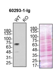 Western Blot (WB) analysis of U2OS cells using OPTN Monoclonal antibody (60293-1-Ig)