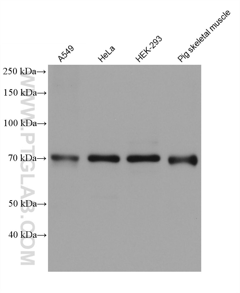 Western Blot (WB) analysis of various lysates using OPTN/Optineurin Monoclonal antibody (60293-1-Ig)