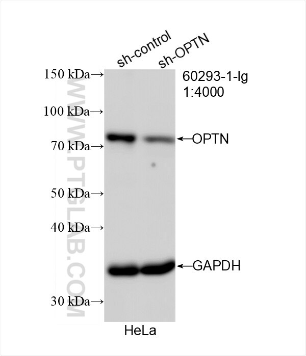 Western Blot (WB) analysis of HeLa cells using OPTN/Optineurin Monoclonal antibody (60293-1-Ig)