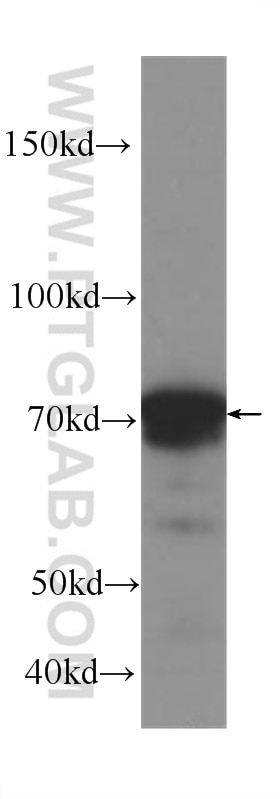 Western Blot (WB) analysis of human heart tissue using OPTN Monoclonal antibody (60293-1-Ig)