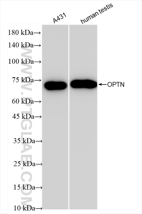 Western Blot (WB) analysis of various lysates using OPTN/Optineurin Recombinant antibody (83634-5-RR)