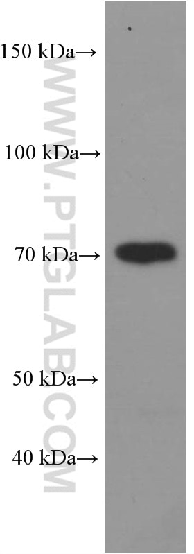 Western Blot (WB) analysis of human brain tissue using Biotin-conjugated OPTN Monoclonal antibody (Biotin-60293)