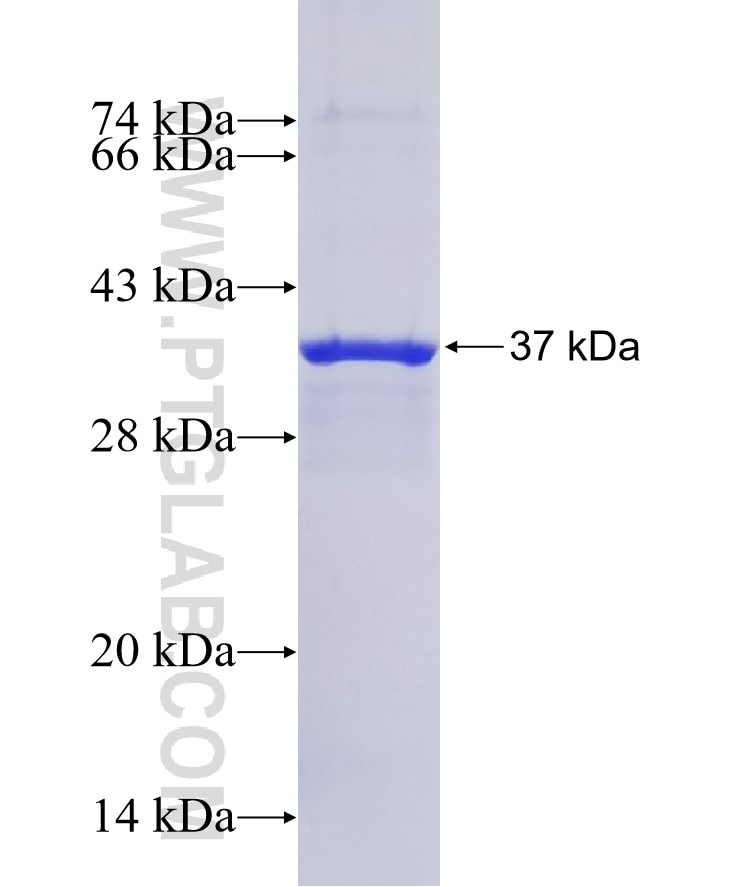 OR2S2 fusion protein Ag14928 SDS-PAGE