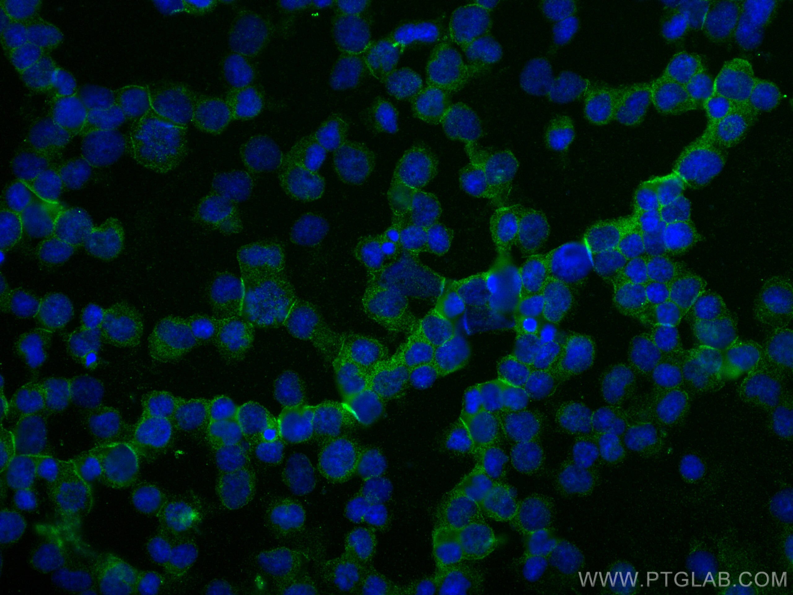 Immunofluorescence (IF) / fluorescent staining of Jurkat cells using OR4K17 Polyclonal antibody (19750-1-AP)