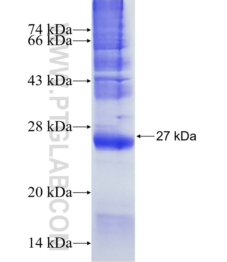 OR9Q1 fusion protein Ag13548 SDS-PAGE OR9Q1 fusion protein Ag13548 SDS-PAGE