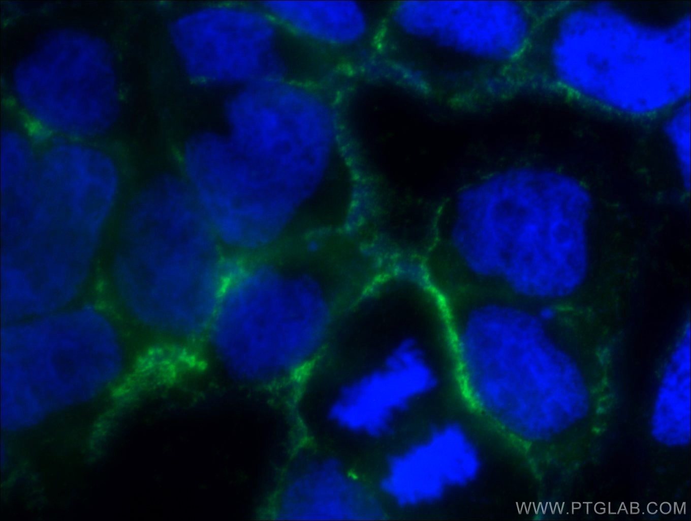 Immunofluorescence (IF) / fluorescent staining of HEK-293 cells using ORAI1 Polyclonal antibody (13130-1-AP)