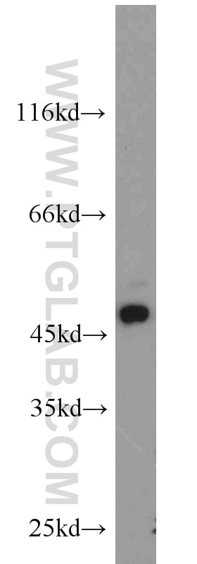 WB analysis of PC-3 using 13130-1-AP