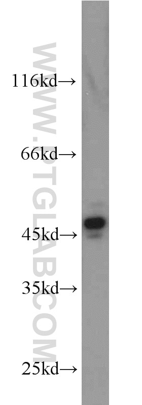 Western Blot (WB) analysis of A375 cells using ORAI1 Polyclonal antibody (13130-1-AP)