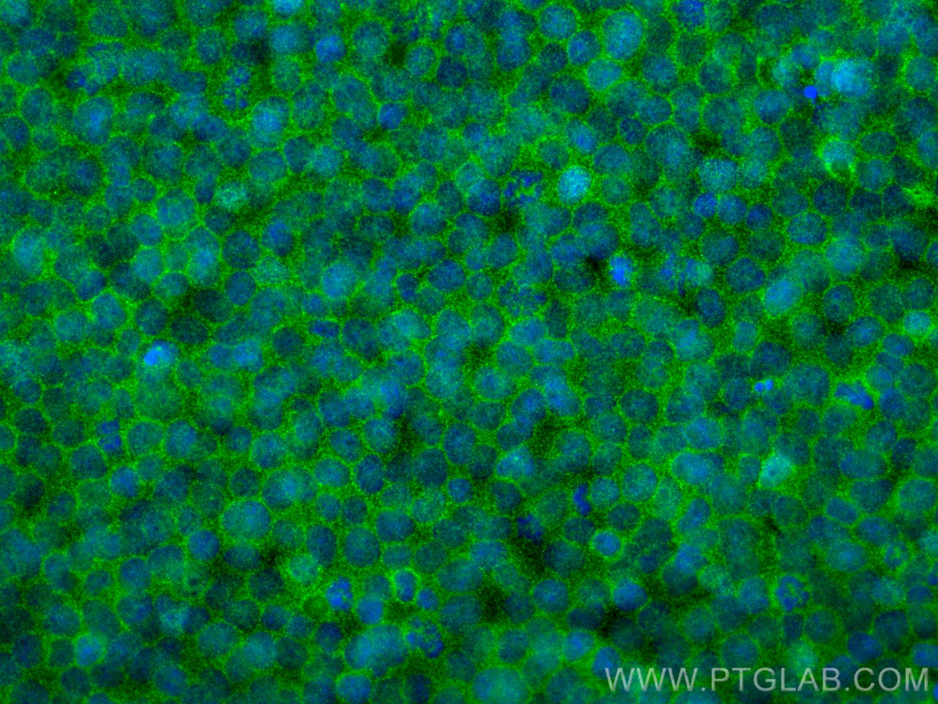 Immunofluorescence (IF) / fluorescent staining of Jurkat cells using ORAI1 Monoclonal antibody (66223-1-Ig)