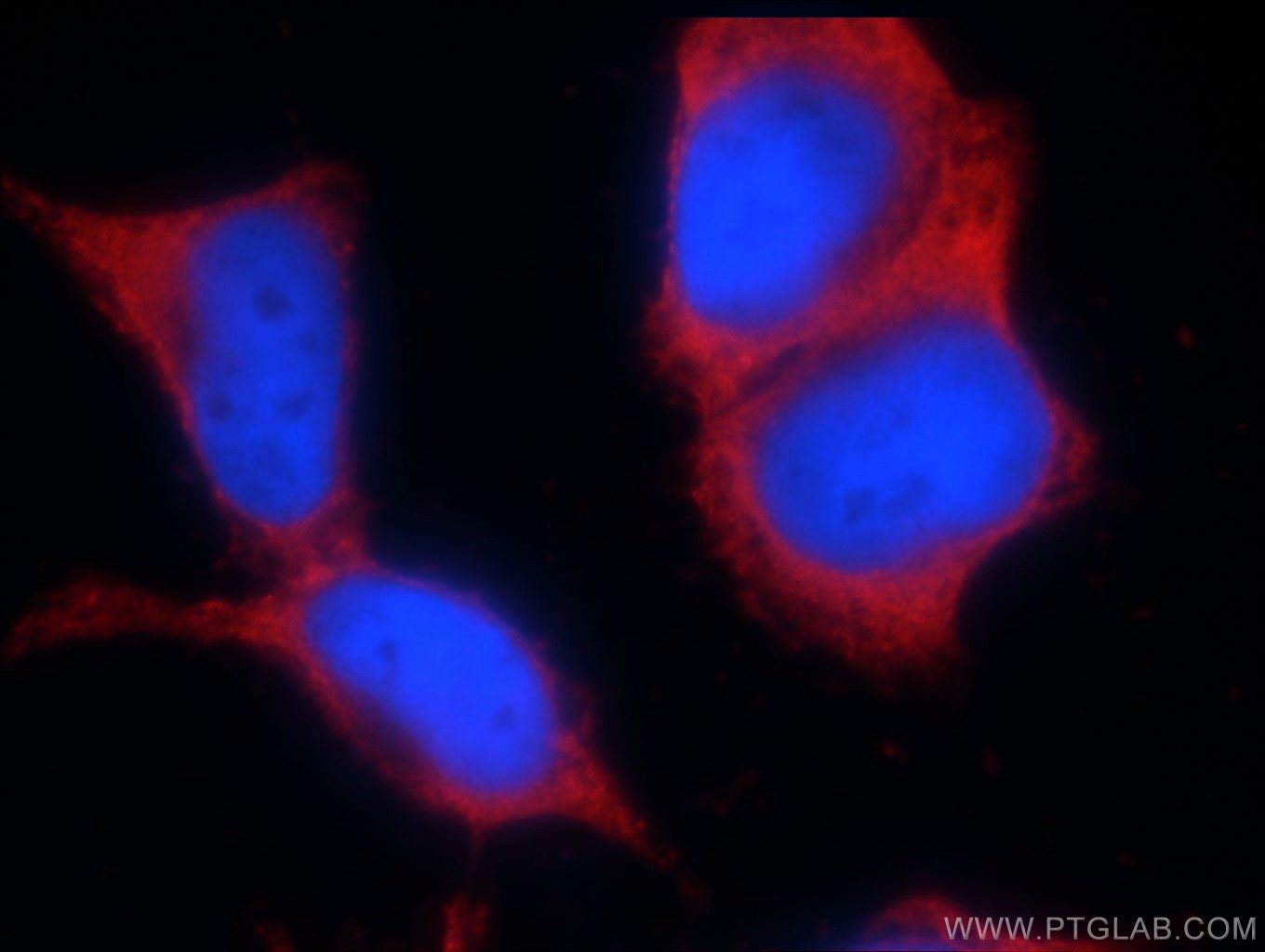 Immunofluorescence (IF) / fluorescent staining of HEK-293 cells using ORAI2 Polyclonal antibody (20592-1-AP)