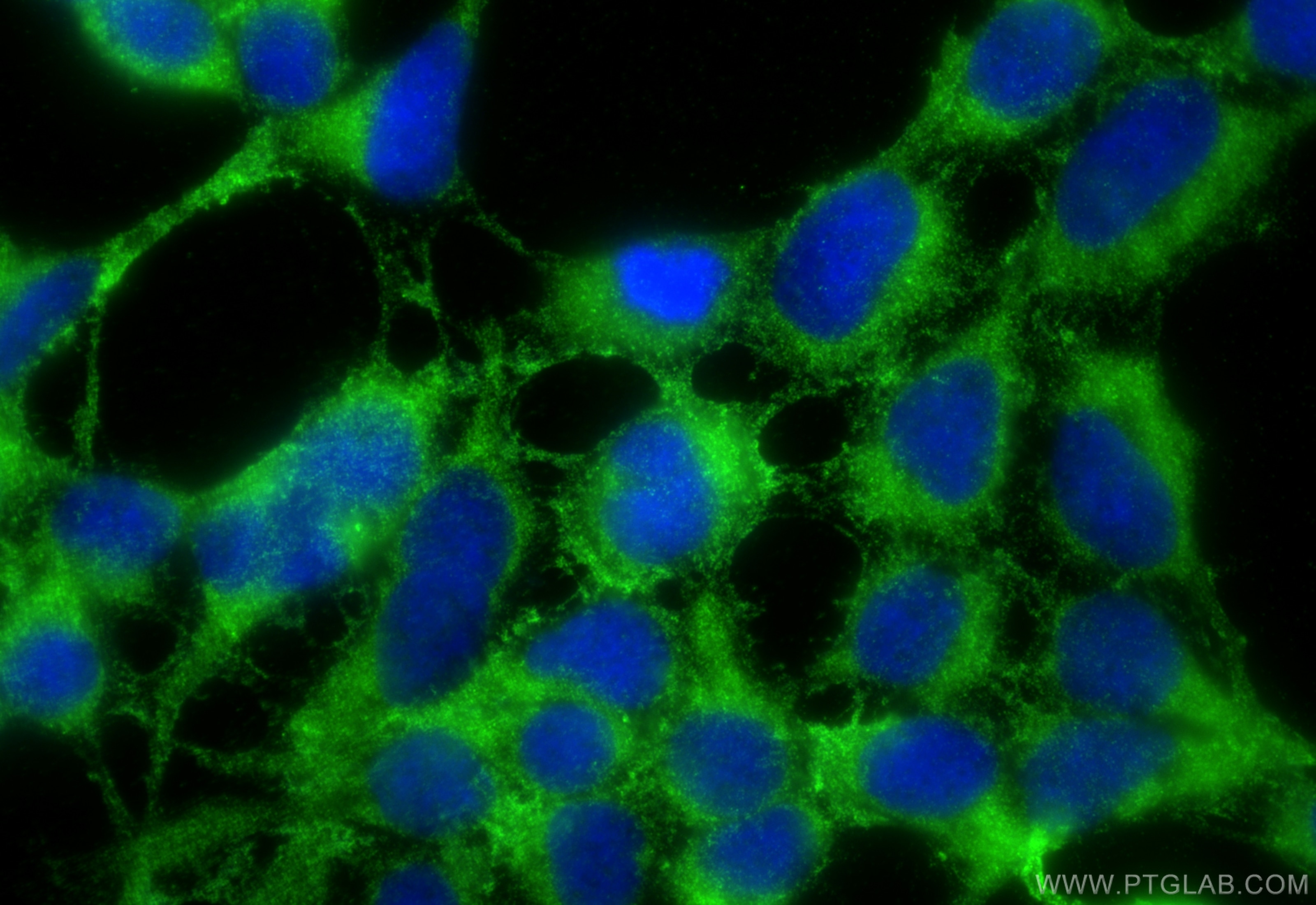 Immunofluorescence (IF) / fluorescent staining of HEK-293 cells using ORAI2 Polyclonal antibody (20592-1-AP)