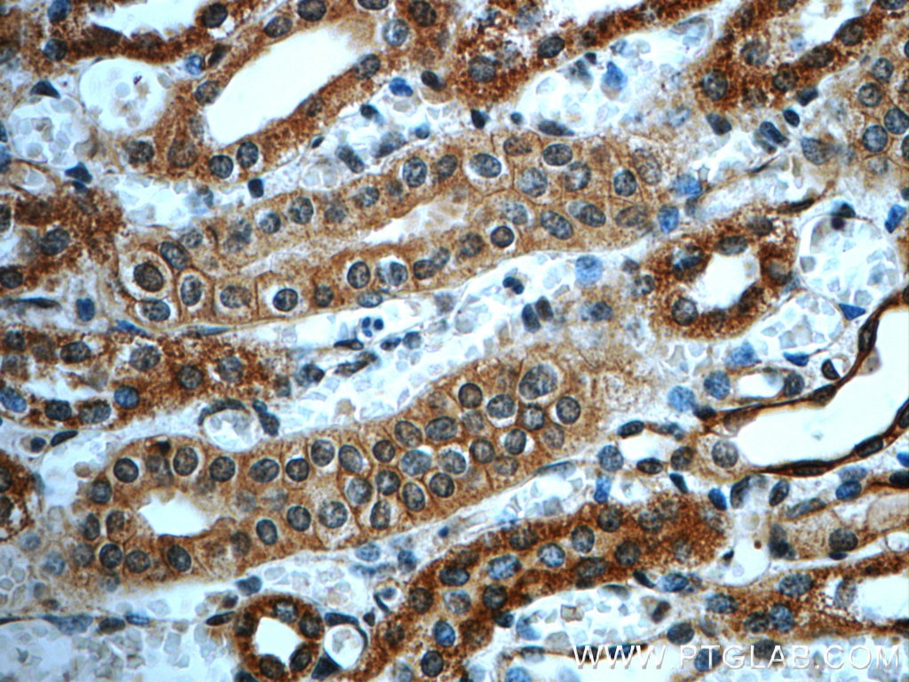 Immunohistochemistry (IHC) staining of human kidney tissue using ORAI2 Polyclonal antibody (20592-1-AP)
