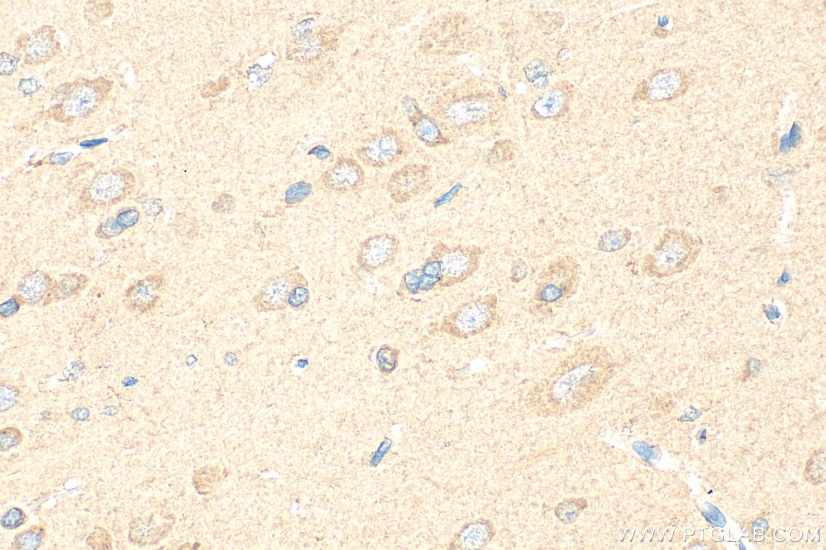 Immunohistochemical analysis of paraffin-embedded rat brain tissue slide using 20592-1-AP (ORAI2 antibody) at dilution of 1:200 (under 40x lens). Heat mediated antigen retrieval with Tris-EDTA buffer (pH 9.0). Immunohistochemistry (IHC) staining of rat brain tissue using ORAI2 Polyclonal antibody (20592-1-AP)