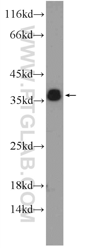 Western Blot (WB) analysis of MCF-7 cells using ORAI2 Polyclonal antibody (20592-1-AP)