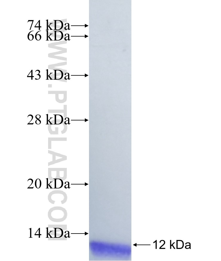 ORAI2 fusion protein Ag40381 SDS-PAGE ORAI2 fusion protein Ag40381 SDS-PAGE