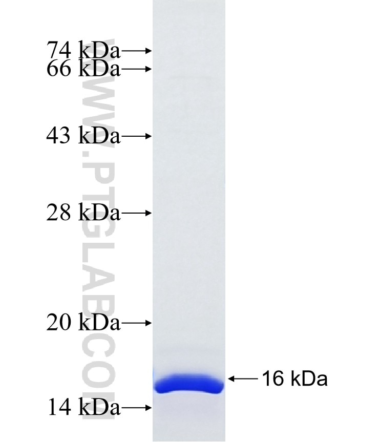 ORAI3 fusion protein Ag40166 SDS-PAGE ORAI3 fusion protein Ag40166 SDS-PAGE