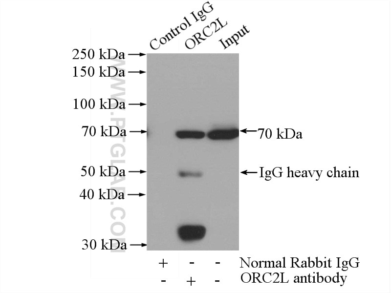 Immunoprecipitation (IP) experiment of HepG2 cells using ORC2L Polyclonal antibody (12739-1-AP)