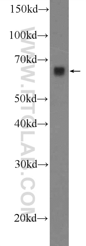 Western Blot (WB) analysis of HepG2 cells using ORC2L Polyclonal antibody (12739-1-AP)