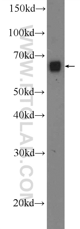 WB analysis of HepG2 using 12739-1-AP