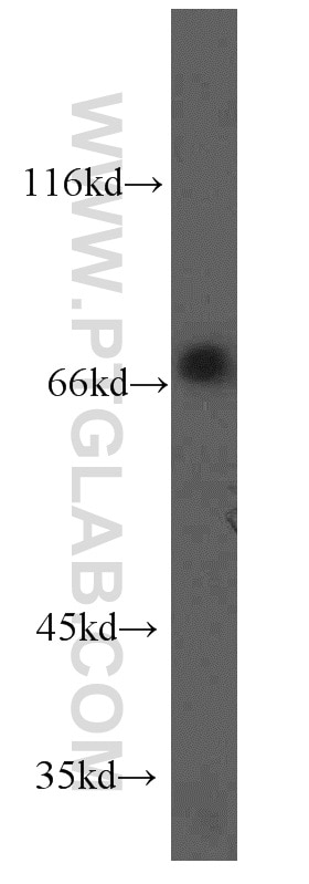 Western Blot (WB) analysis of HepG2 cells using ORC2L Polyclonal antibody (12739-1-AP)