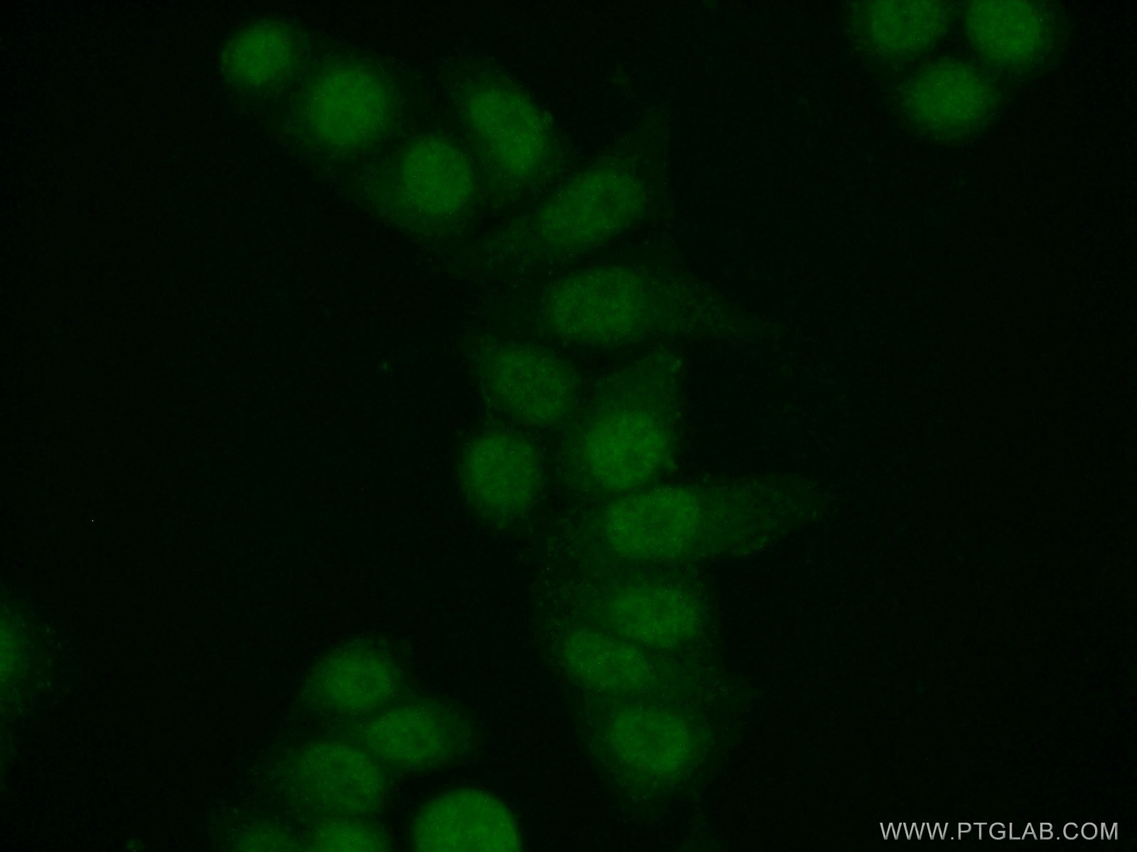Immunofluorescence (IF) / fluorescent staining of HeLa cells using ORC4L Polyclonal antibody (13026-1-AP)