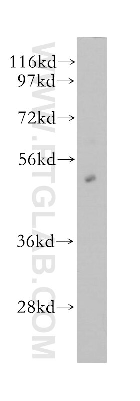 Western Blot (WB) analysis of human kidney tissue using ORC5L Polyclonal antibody (11542-1-AP)