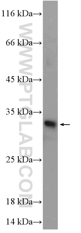 Western Blot (WB) analysis of mouse spleen tissue using ORC6 Polyclonal antibody (17784-1-AP)