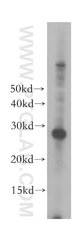 Western Blot (WB) analysis of Jurkat cells using ORC6 Polyclonal antibody (17784-1-AP)