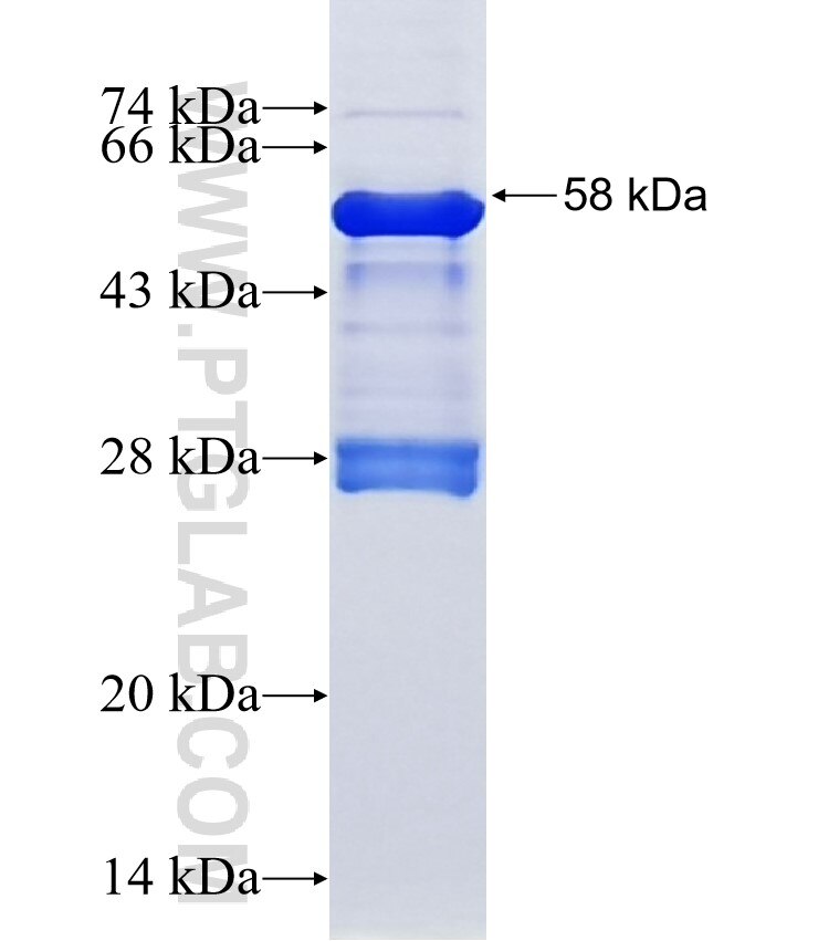 ORC6L fusion protein Ag11769 SDS-PAGE