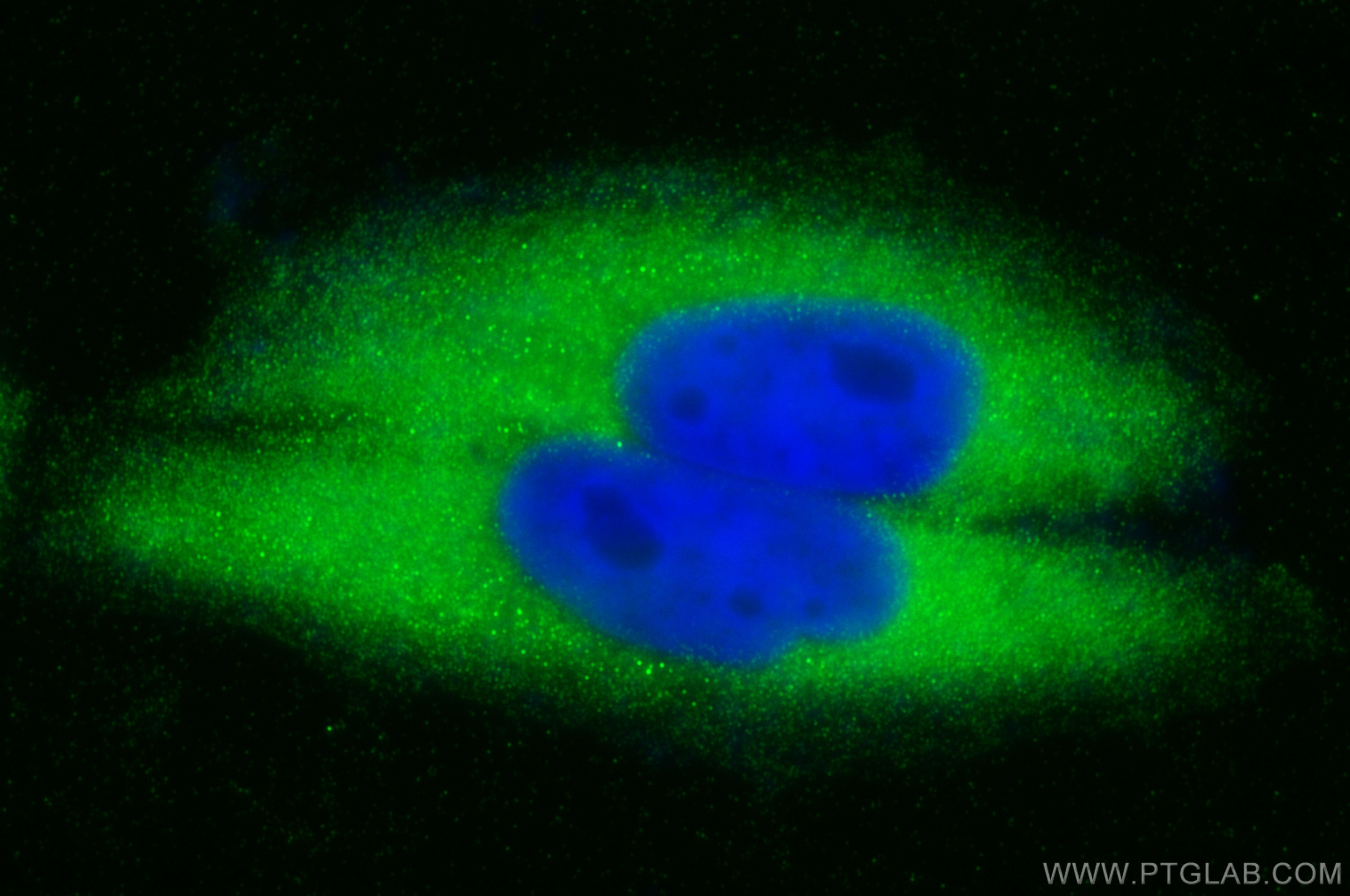 Immunofluorescence (IF) / fluorescent staining of HepG2 cells using ORM1 Polyclonal antibody (16439-1-AP)