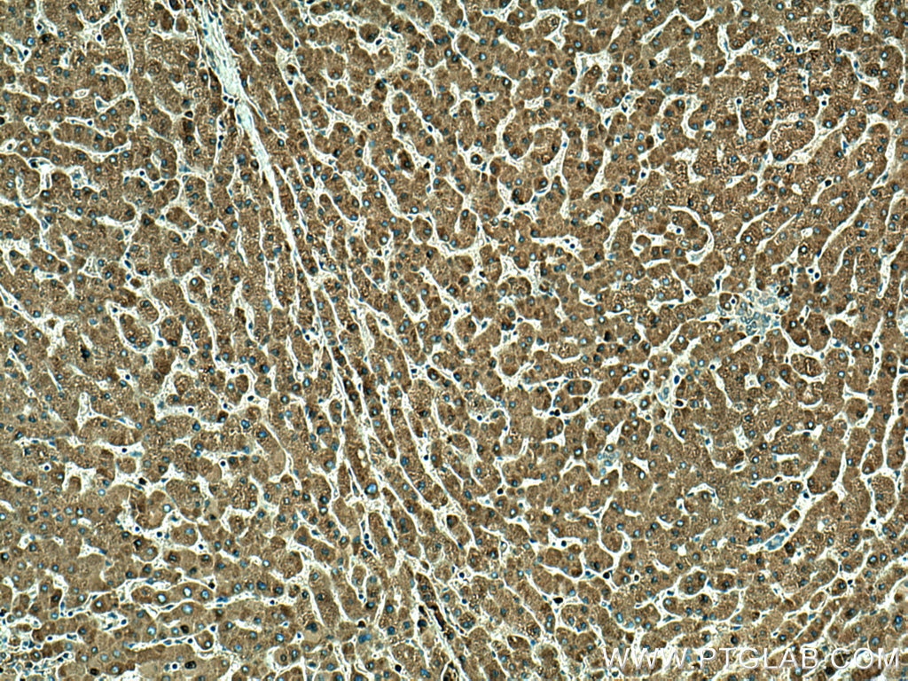 Immunohistochemistry (IHC) staining of human liver tissue using ORM1 Polyclonal antibody (16439-1-AP)