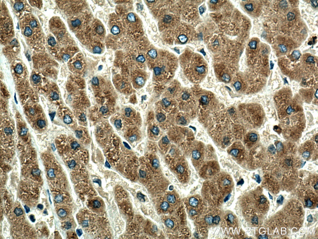 Immunohistochemistry (IHC) staining of human liver tissue using ORM1 Polyclonal antibody (16439-1-AP)
