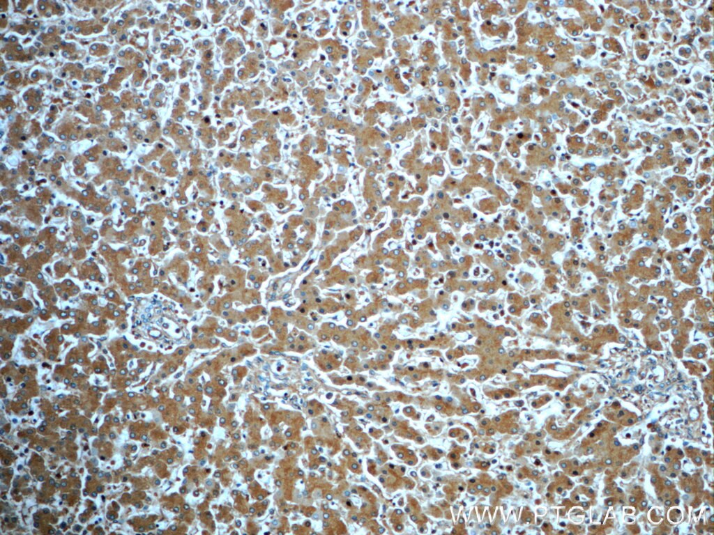 ORM1 Polyclonal antibody