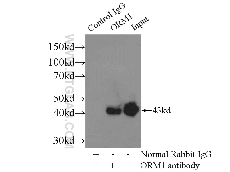 IP experiment of human plasma using 16439-1-AP