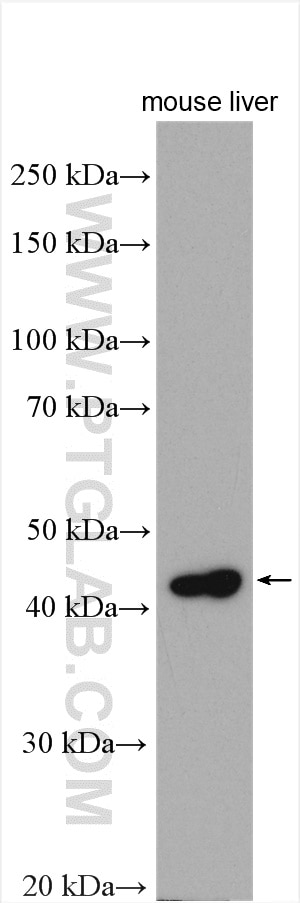 Western Blot (WB) analysis of various lysates using ORM1 Polyclonal antibody (16439-1-AP)