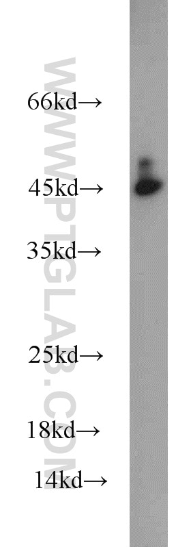 Western Blot (WB) analysis of mouse bladder tissue using ORM1 Polyclonal antibody (16439-1-AP)