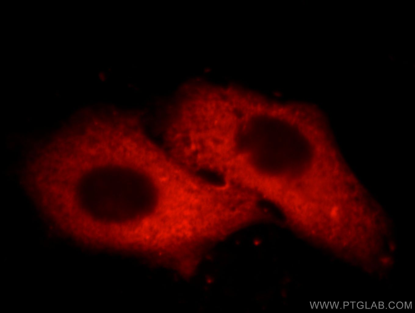 Immunofluorescence (IF) / fluorescent staining of HepG2 cells using ORM1/2 Monoclonal antibody (66097-1-Ig)