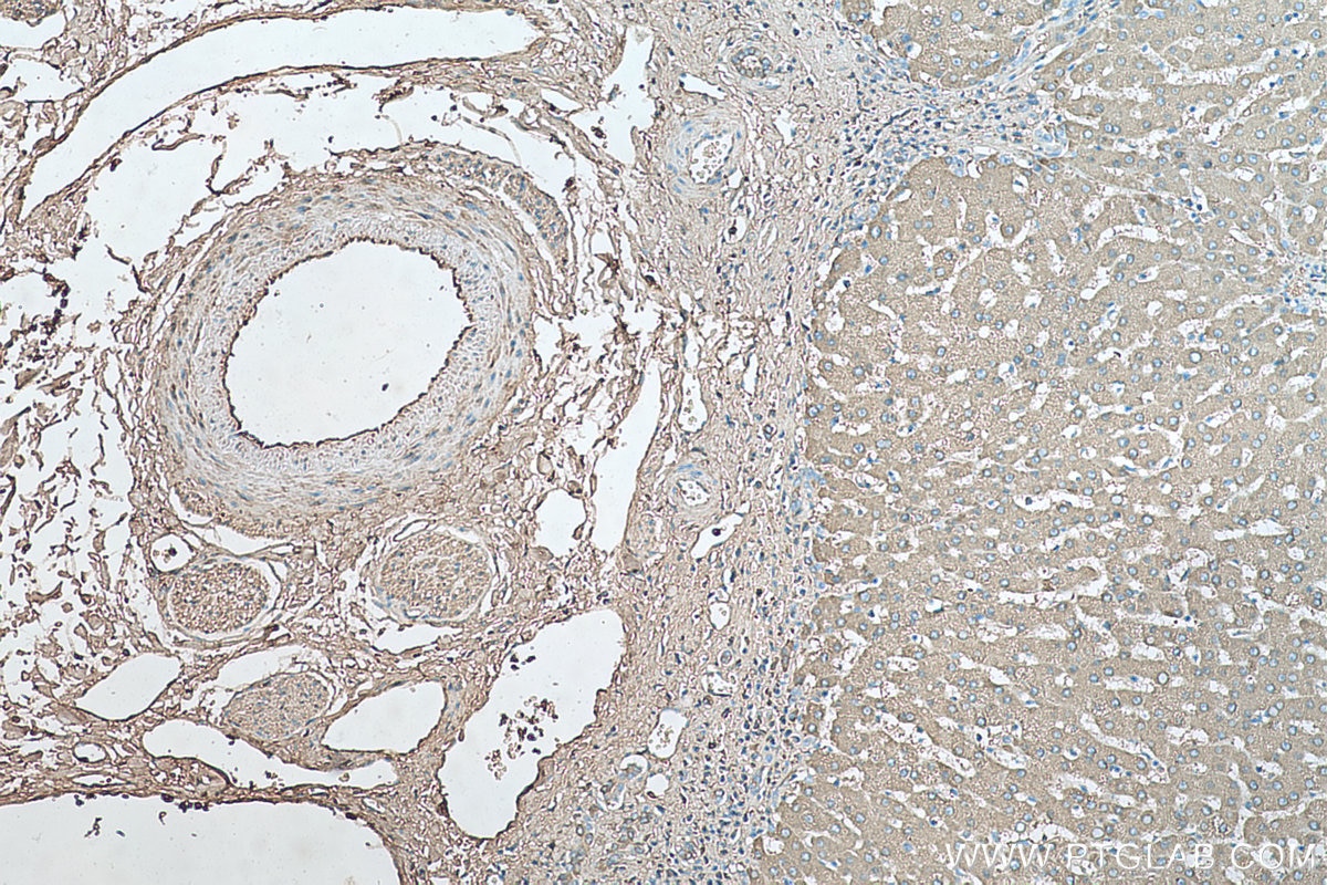 Immunohistochemistry (IHC) staining of human liver tissue using ORM1/2 Monoclonal antibody (66097-1-Ig)