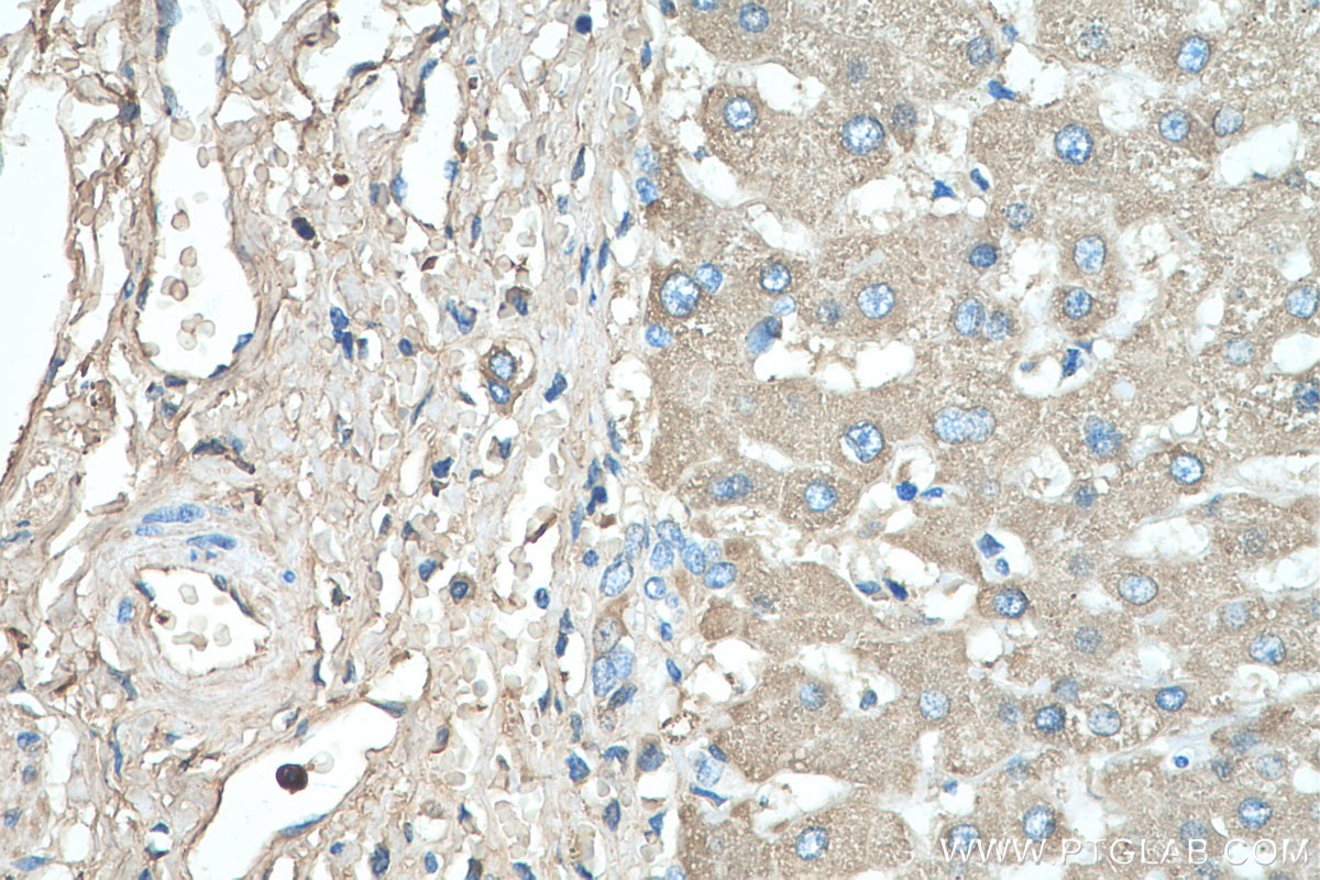 Immunohistochemistry (IHC) staining of human liver tissue using ORM1/2 Monoclonal antibody (66097-1-Ig)