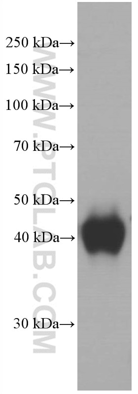 Western Blot (WB) analysis of human plasma using ORM1/2 Monoclonal antibody (66097-1-Ig)