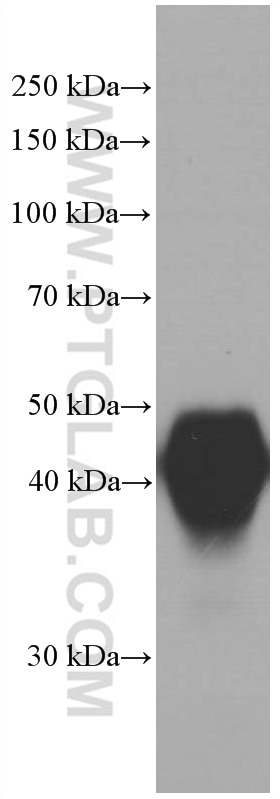 Western Blot (WB) analysis of human testis tissue using ORM1/2 Monoclonal antibody (66097-1-Ig)