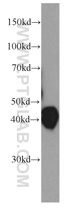 ORM1/2 Monoclonal antibody