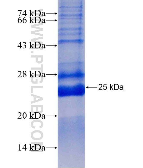 ORM1 fusion protein Ag19248 SDS-PAGE