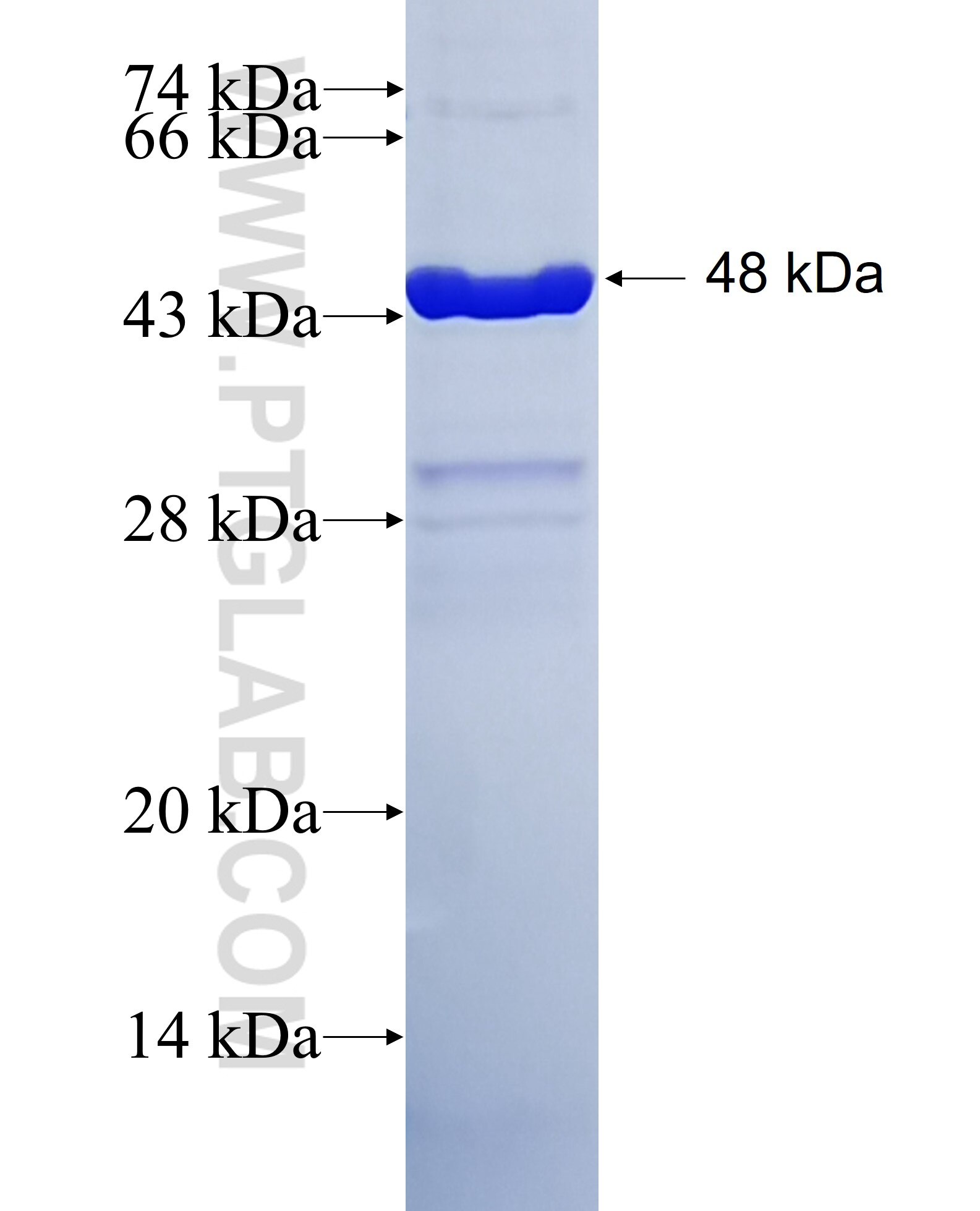 ORM1 fusion protein Ag9758 SDS-PAGE