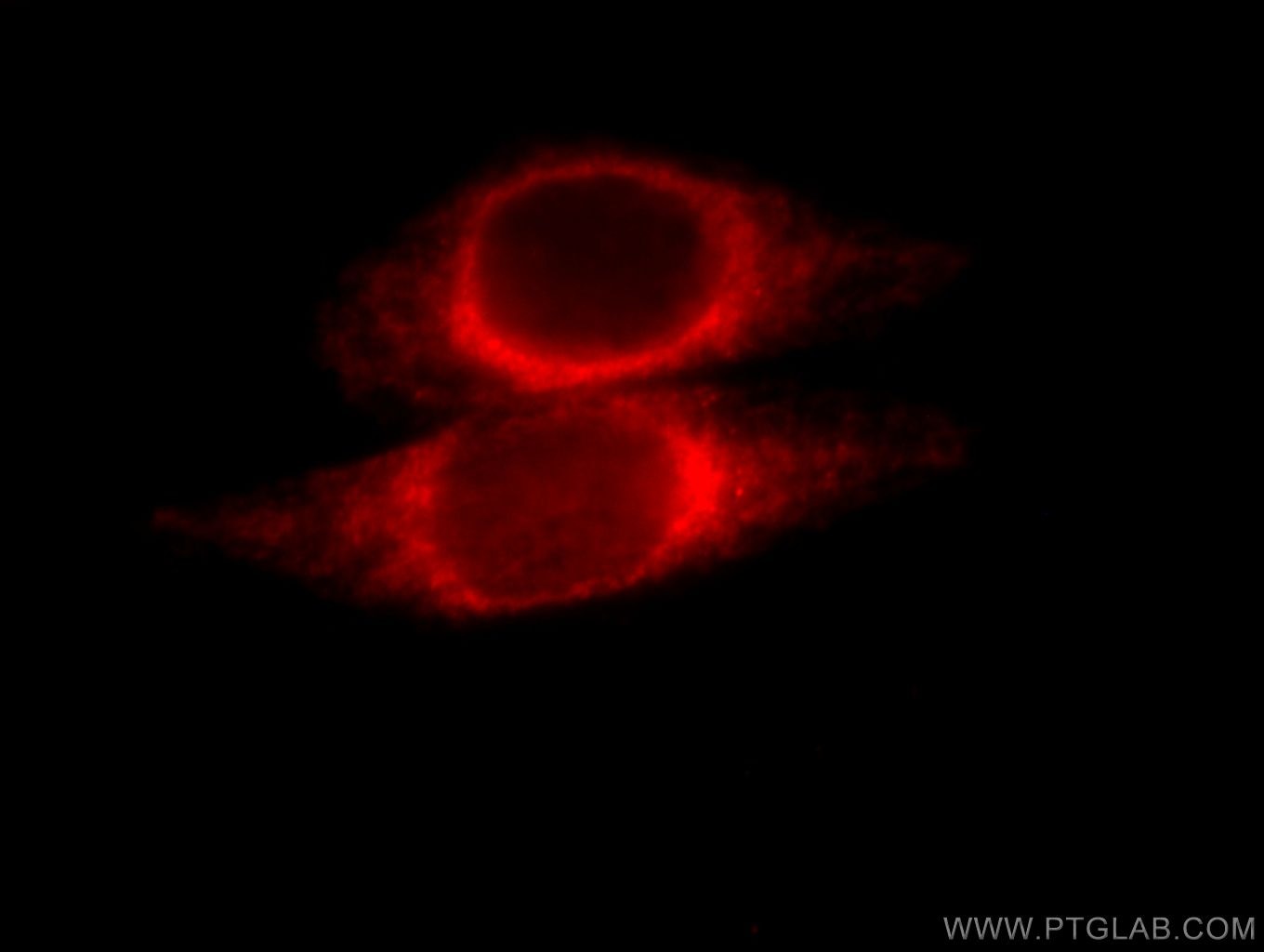 Immunofluorescence (IF) / fluorescent staining of HeLa cells using ORM1/2 Polyclonal antibody (11199-1-AP)