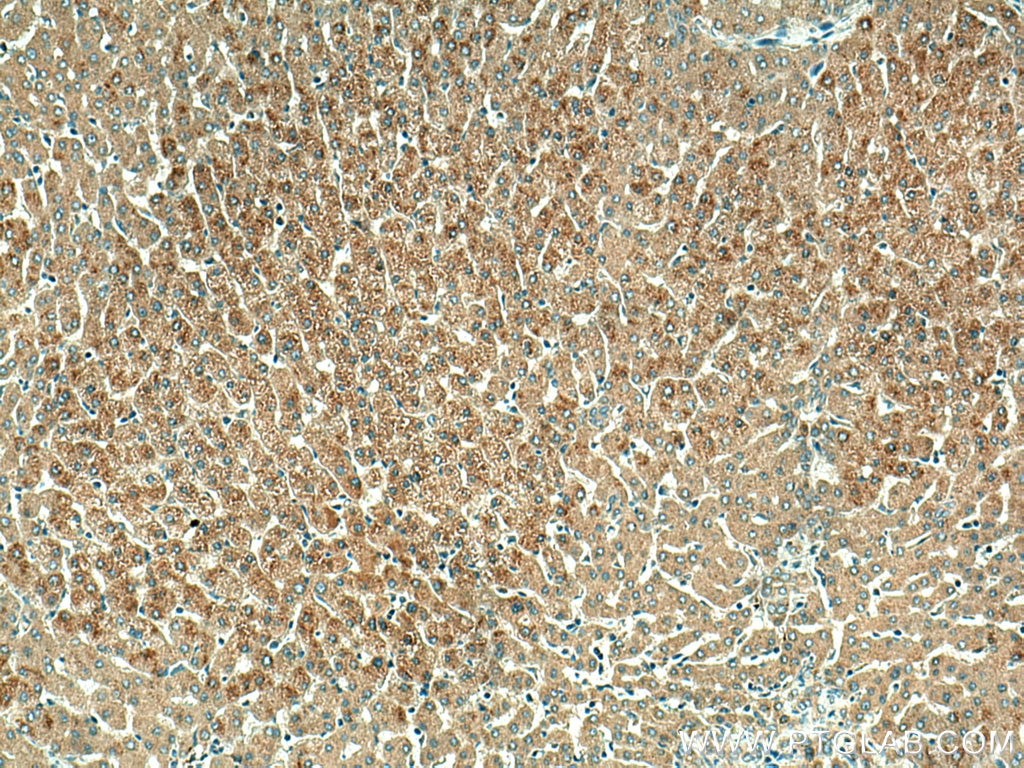 Immunohistochemistry (IHC) staining of human liver tissue using ORM1/2 Polyclonal antibody (11199-1-AP)