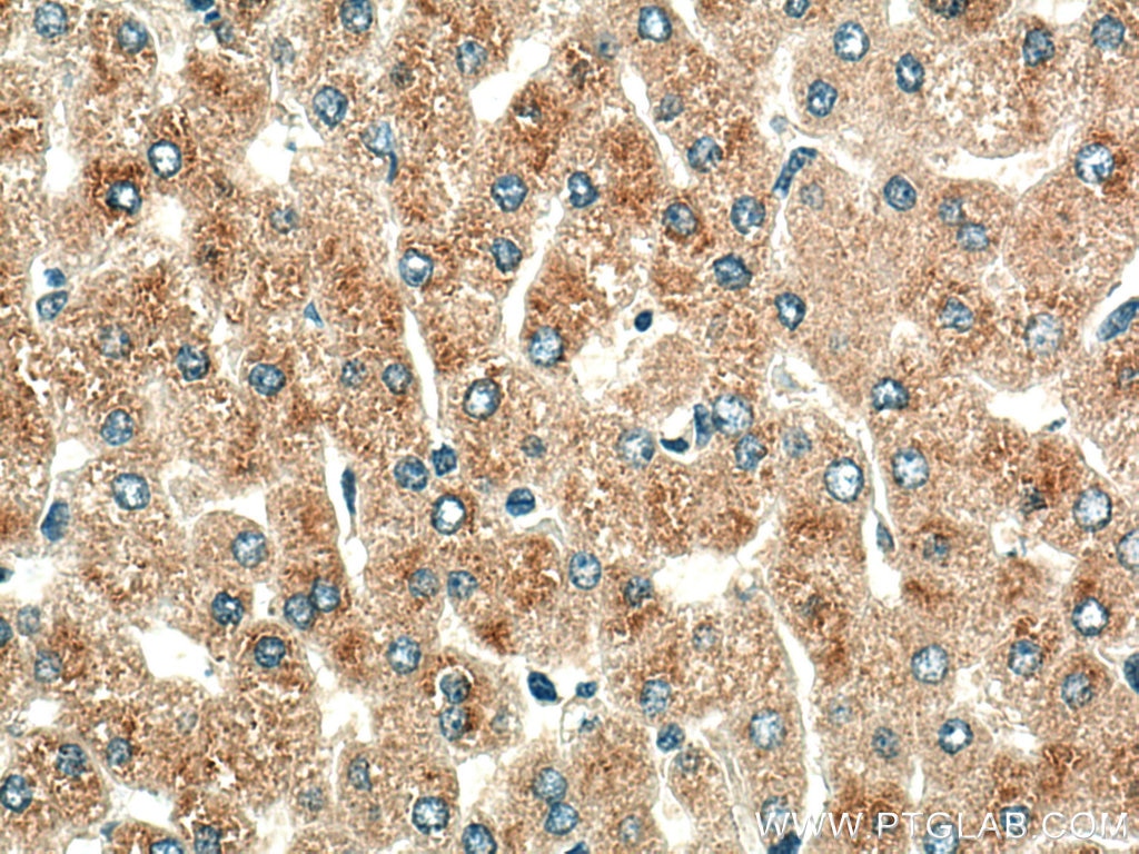 Immunohistochemistry (IHC) staining of human liver tissue using ORM1/2 Polyclonal antibody (11199-1-AP)
