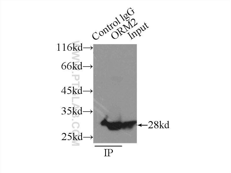 Immunoprecipitation (IP) experiment of L02 cells using ORM1/2 Polyclonal antibody (11199-1-AP)