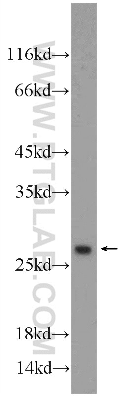 Western Blot (WB) analysis of mouse liver tissue using ORM1/2 Polyclonal antibody (11199-1-AP)